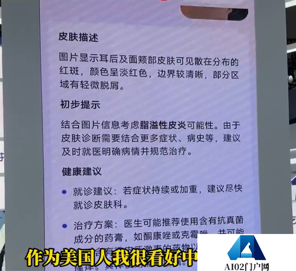 博主坦言美国看病太贵太麻烦：想把中国的AI医生带回去